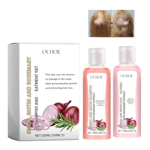 Onion Biotin and Rosemary Shampoo & Conditioner Hair Care Set for All Hair Types
