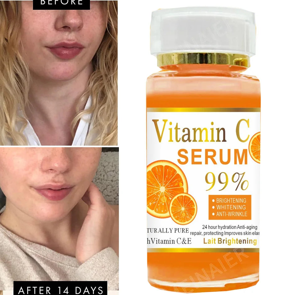 Advanced Vitamin C Glow Serum with AHA, Kojic Acid & Glutathione – 120ml Premium Skin Brightening & Anti-Aging Formula for Dark Spots, Wrinkles, and Radiant Skin - Premium face serum from Lizard Vigilante - Just $36.88! Shop now at Lizard Vigilante