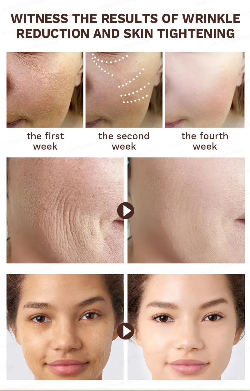 wrinkles disappear become beautiful now - Premium  from Lizard Vigilante - Just $45.99! Shop now at Lizard Vigilante