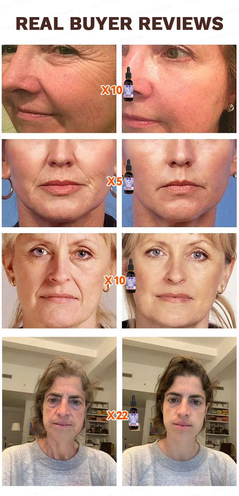 wrinkles disappear become beautiful now - Premium  from Lizard Vigilante - Just $45.99! Shop now at Lizard Vigilante