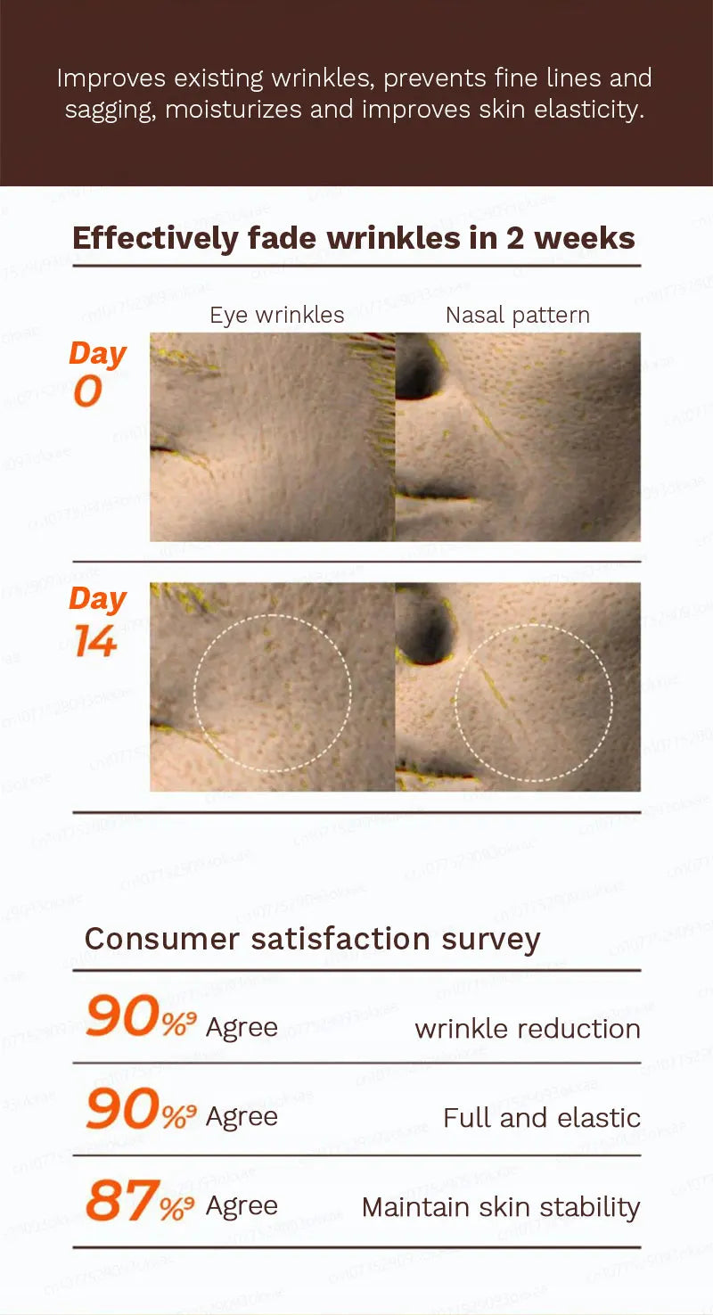 wrinkles disappear become beautiful now - Premium  from Lizard Vigilante - Just $45.99! Shop now at Lizard Vigilante