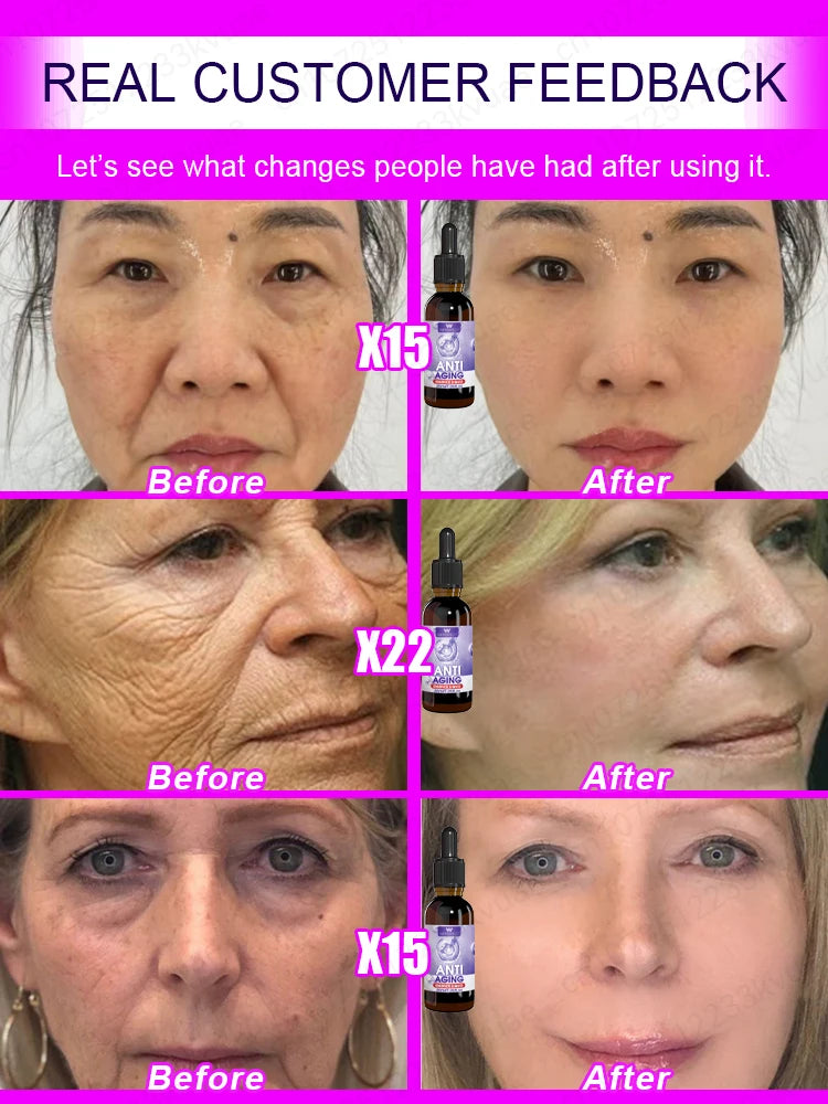 wrinkles disappear become beautiful now - Premium  from Lizard Vigilante - Just $45.99! Shop now at Lizard Vigilante