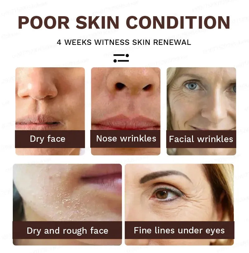 wrinkles disappear become beautiful now - Premium  from Lizard Vigilante - Just $45.99! Shop now at Lizard Vigilante