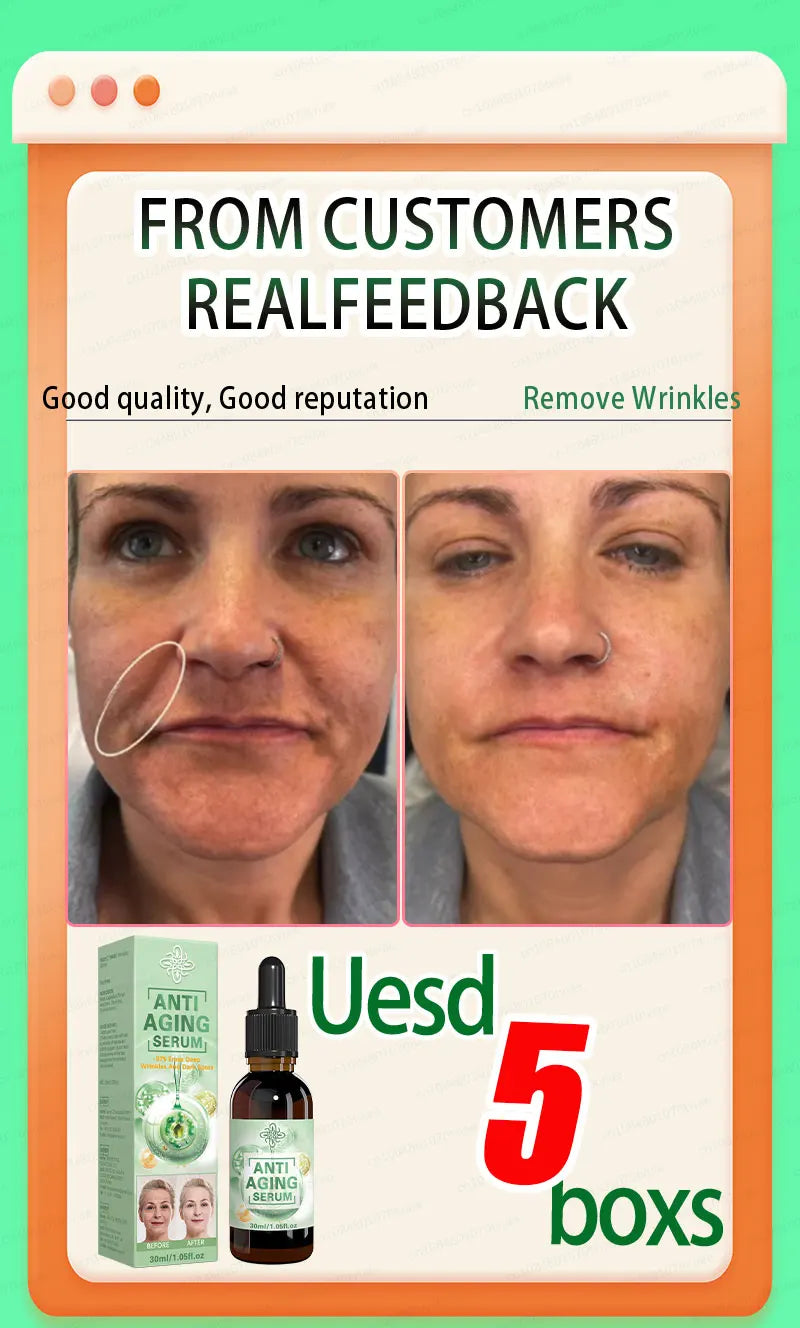 Wrinkle Wipeout – Anti-Age Serum So Fierce It Scares Time - Premium anti aging serum from dsers - Just $44.99! Shop now at Lizard Vigilante