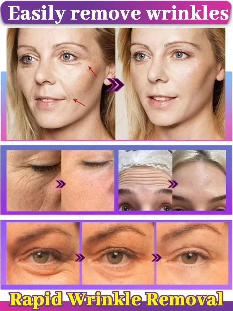 Wrinkle Wipeout – Anti-Age Serum So Fierce It Scares Time - Premium anti aging serum from dsers - Just $43.99! Shop now at Lizard Vigilante