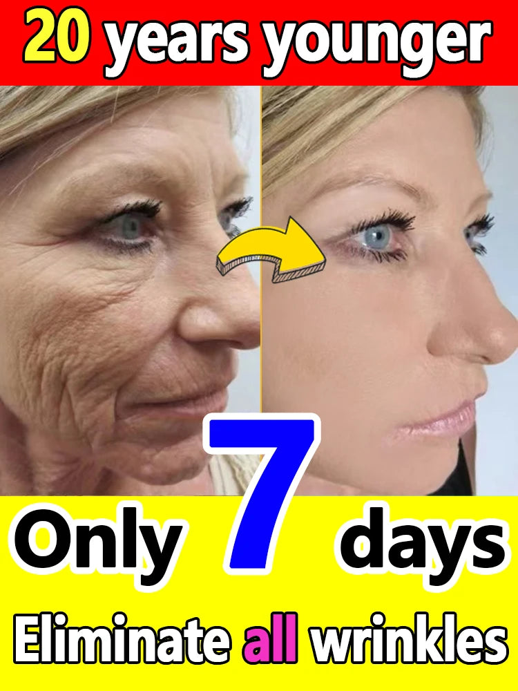 Wrinkle Hitman 100X — Liquid Anti-Aging Serum for Eyes, Face & Neck (Hollywood-Grade Formula) - Premium serum from dsers - Just $44.99! Shop now at Lizard Vigilante