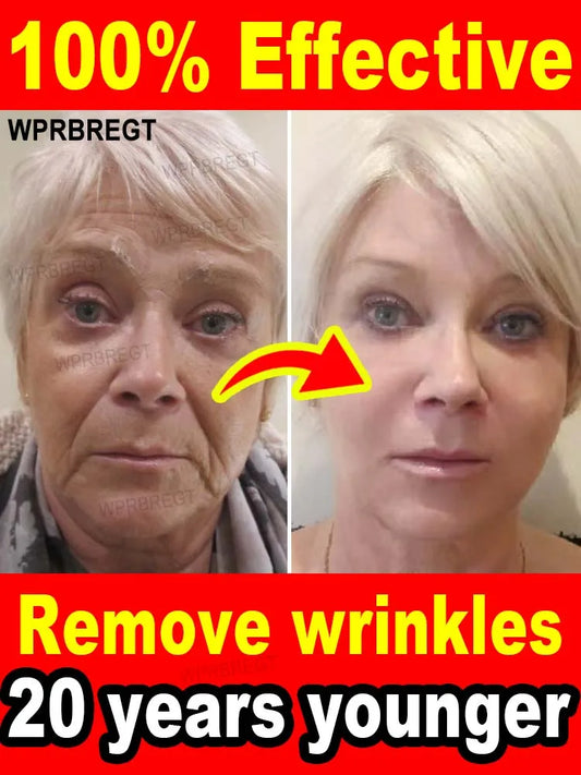 Wrinkle Hitman 100X — Liquid Anti-Aging Serum for Eyes, Face & Neck (Hollywood-Grade Formula) - Premium serum from dsers - Just $45.99! Shop now at Lizard Vigilante