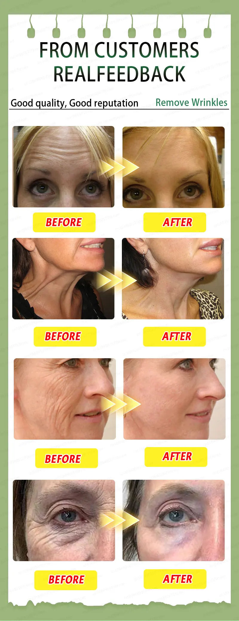 Wrinkle Wipeout – Anti-Age Serum So Fierce It Scares Time - Premium anti aging serum from dsers - Just $44.99! Shop now at Lizard Vigilante