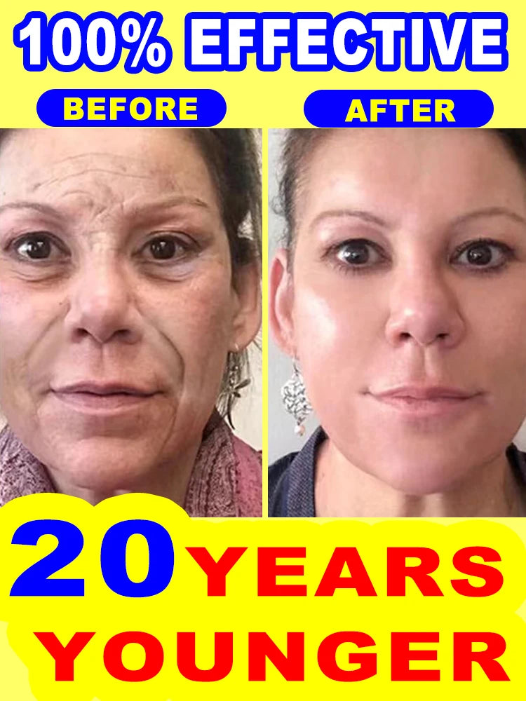 wrinkles disappear become beautiful now - Premium  from Lizard Vigilante - Just $45.99! Shop now at Lizard Vigilante